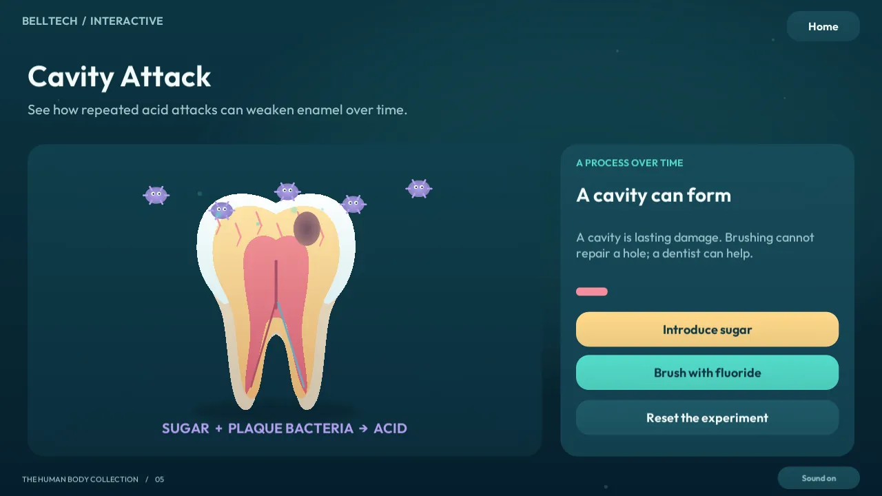 Cavity Attack: a simplified model of acid wearing enamel over time