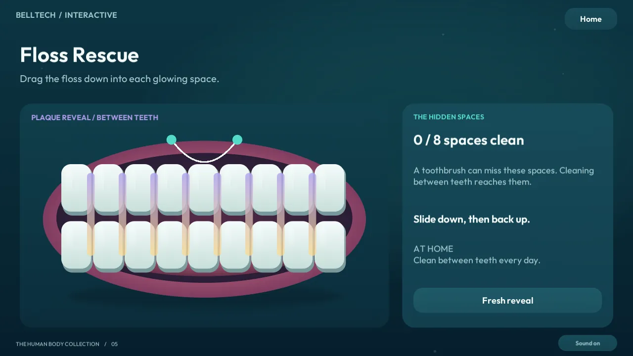 Floss Rescue: dragging floss into the spaces between teeth